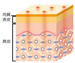 image2-2