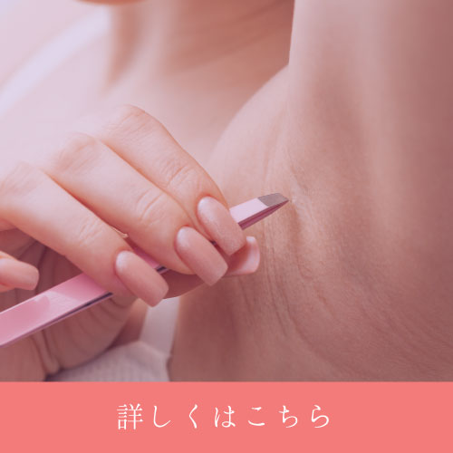 ムダ毛